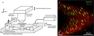 Improved Quantification of Cell Density in the Arterial Wall—A Novel Nucleus Splitting Approach Applied to 3D Two-Photon Laser-Scanning Microscopy